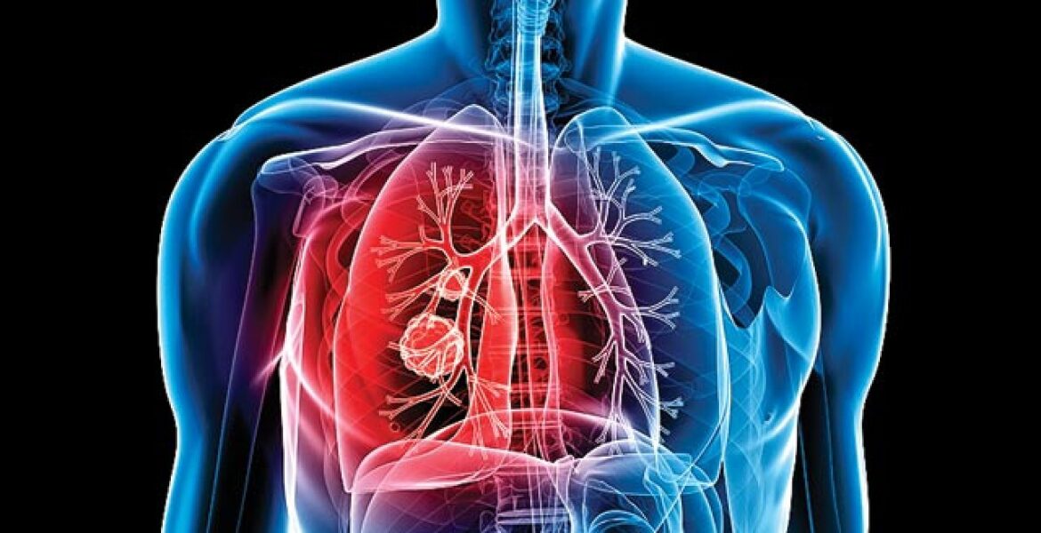 a-new-substance-is-able-to-cure-tuberculosis-effectively