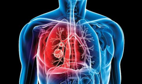 a-new-substance-is-able-to-cure-tuberculosis-effectively